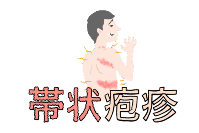 【要注意】帯状疱疹の激痛は「骨折より痛い」— 著名人の体験に学ぶ、後遺症（帯状疱疹後神経痛）を防ぐ「72時間の壁？」と専門治療についてのアイキャッチ画像