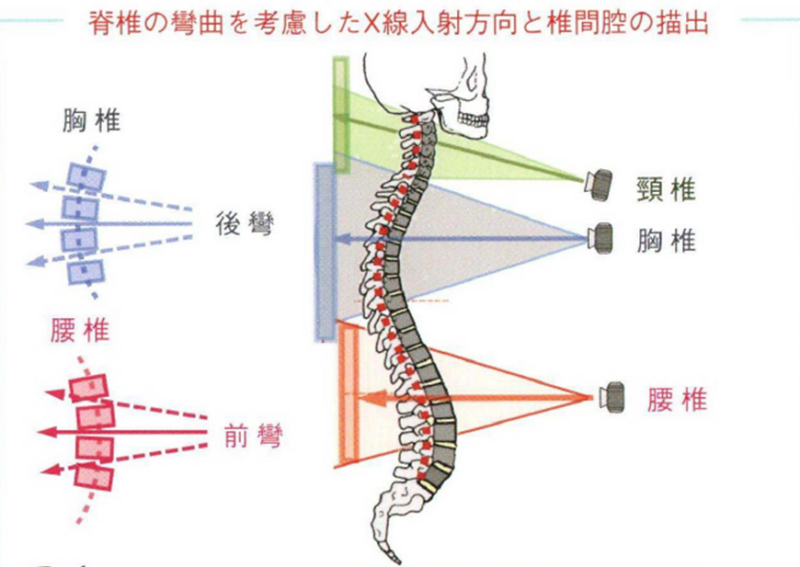 腰椎のレントゲンは、立った状態（立位）で行っています