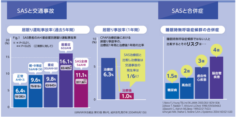 睡眠時無呼吸症候群に対するCPAP導入について　