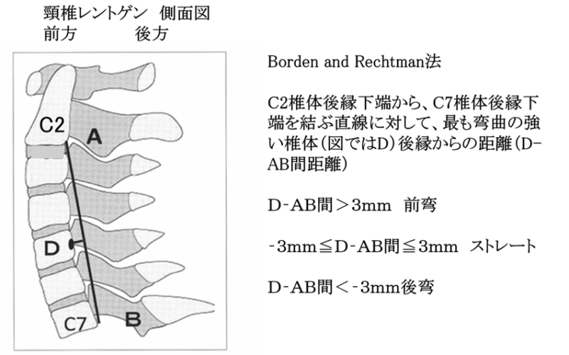 頸部レントゲン側面像について・・・レントゲンで何をチェックしているのか